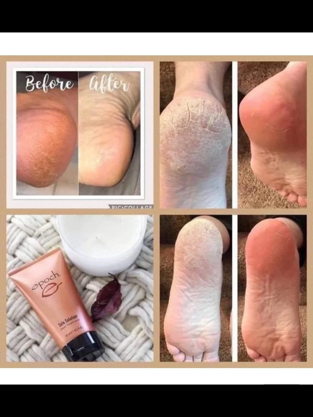 Epoch Sole Solution Foot Treatment - New Sealed 4 Oz